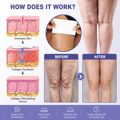 Slimoly™ Instant Thigh Lift Patches ✨